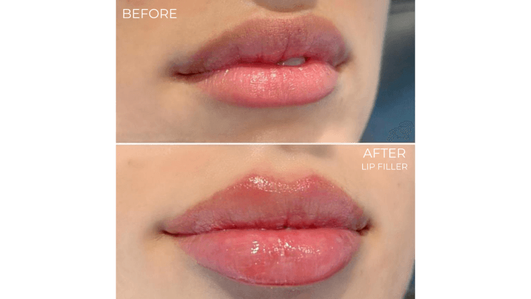 face-boutique-before-after-1