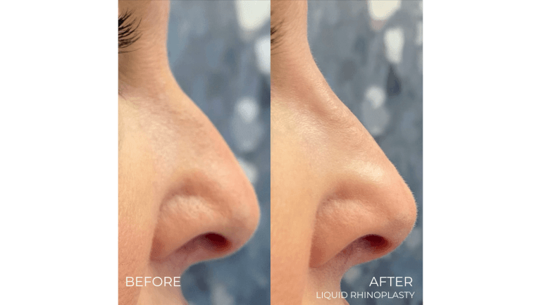face-boutique-before-after-12