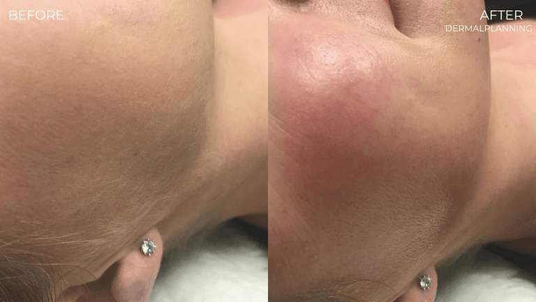face-boutique-before-after-5