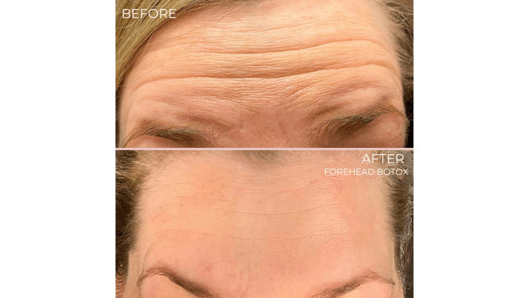 face-boutique-before-after-7