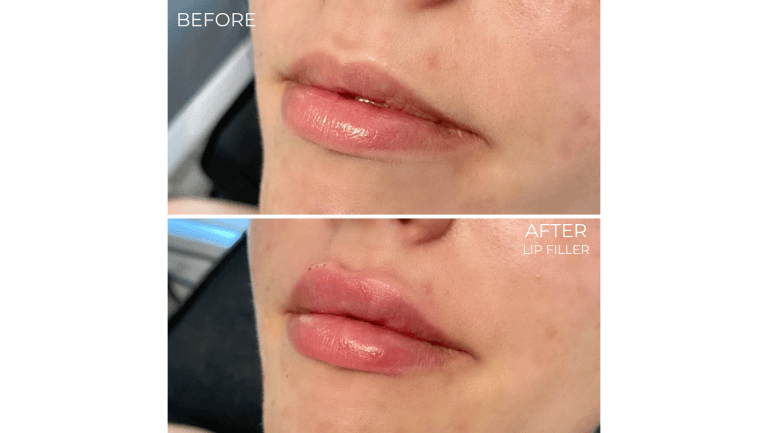 face-boutique-before-after-8