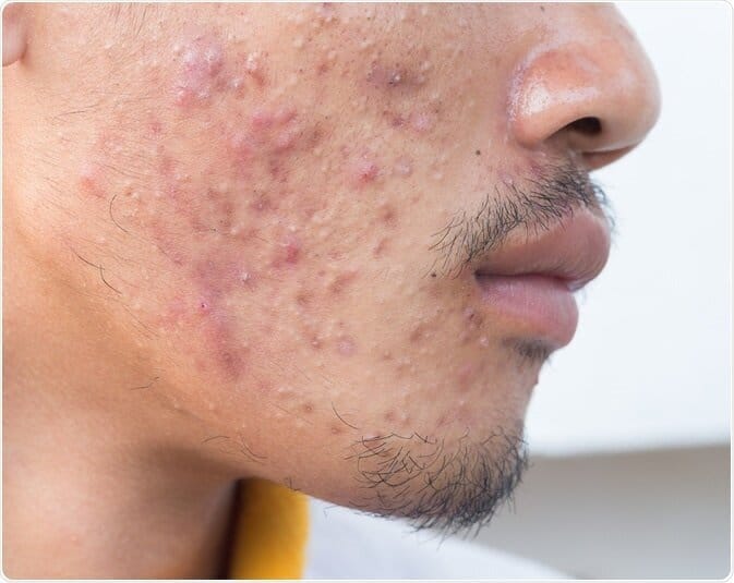 face-boutique-zo-skin-health